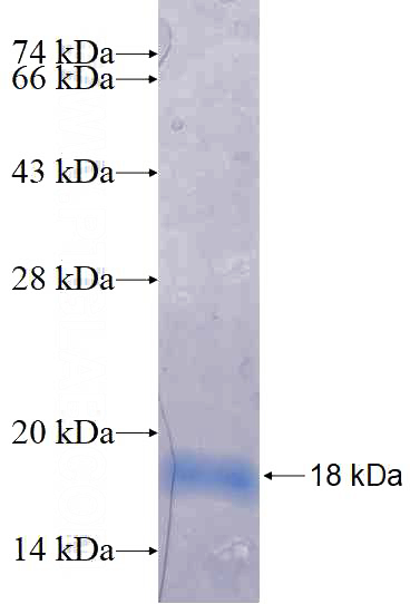 Recombinant Human PPARG SDS-PAGE
