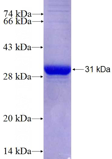 Recombinant Human LANCL3 SDS-PAGE