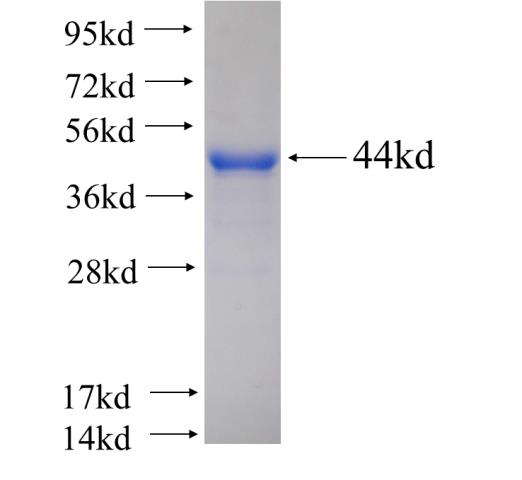Recombinant human AARS SDS-PAGE