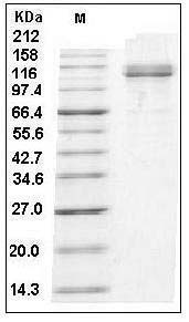 Human VCAM-1 / CD106 Protein (Fc Tag) SDS-PAGE
