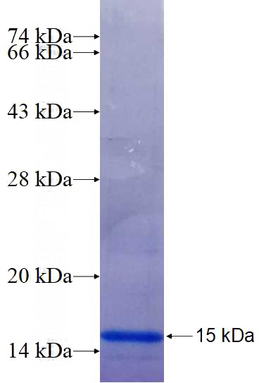 Recombinant Human MGP SDS-PAGE