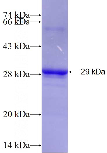 Recombinant Human JUNB SDS-PAGE