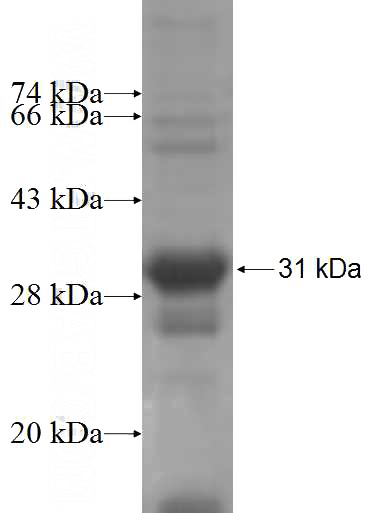 Recombinant Human ARHGDIG SDS-PAGE