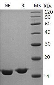 Human CST2 (His tag) recombinant protein