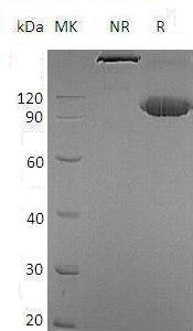 Human EPHA2/ECK (Fc tag) recombinant protein