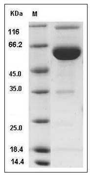 Rat ESAM / Endothelial Cell Adhesion Molecule Protein (Fc Tag) SDS-PAGE