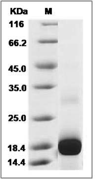 Human CCL23 / MIP 3 Protein (His Tag) SDS-PAGE