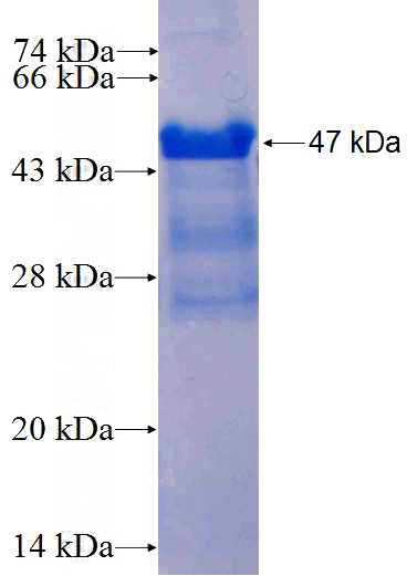 Recombinant Human SLIT1 SDS-PAGE