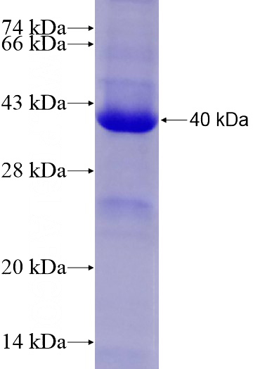 Recombinant Human RPA1 SDS-PAGE