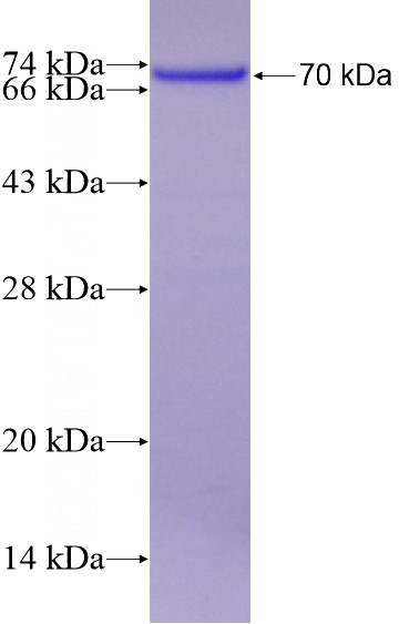 Recombinant Human MEPE SDS-PAGE