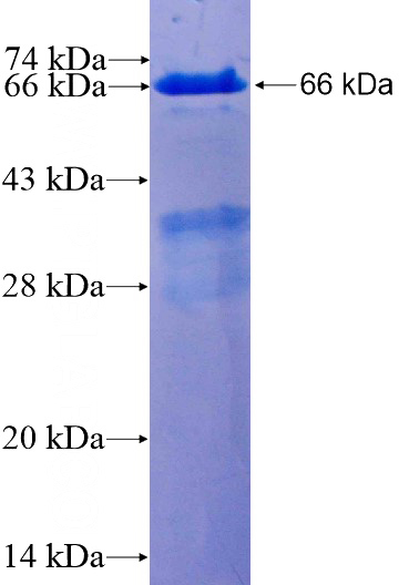 Recombinant Human PLEK SDS-PAGE