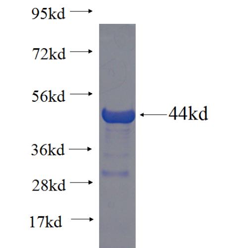 Recombinant human TTC28 SDS-PAGE