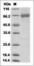 Influenza B (B/PHUKET/3073/2013) Hemagglutinin / HA Protein (His Tag)\n