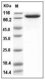 Human IL18RAP / IL1R7 Protein (Fc Tag) SDS-PAGE