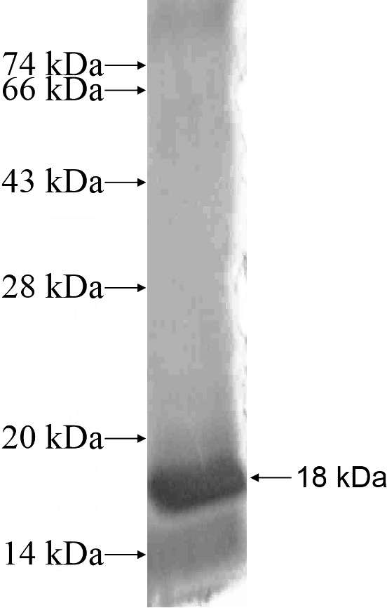 Recombinant Human ZNF460 SDS-PAGE
