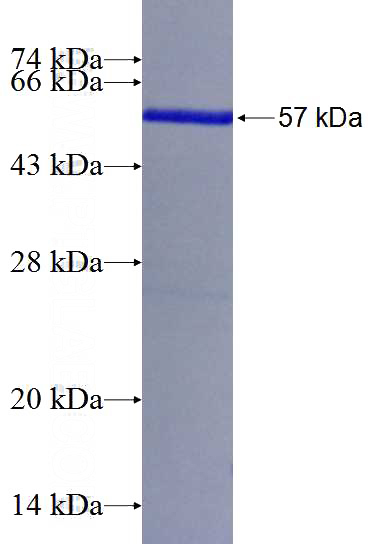 Recombinant Human RNF4 SDS-PAGE