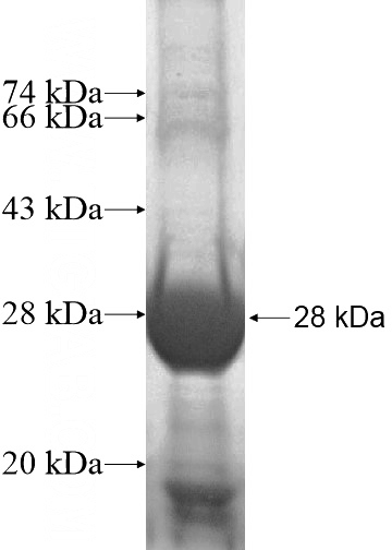 Recombinant Human ARMC10 SDS-PAGE
