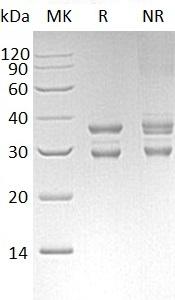 Human UBE2J2/NCUBE2 (GST tag) recombinant protein