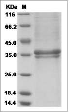 AGRP protein SDS-PAGE