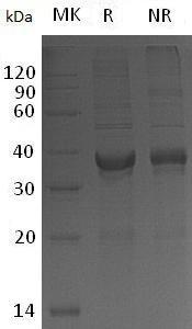 Human RSPO1 (His tag) recombinant protein