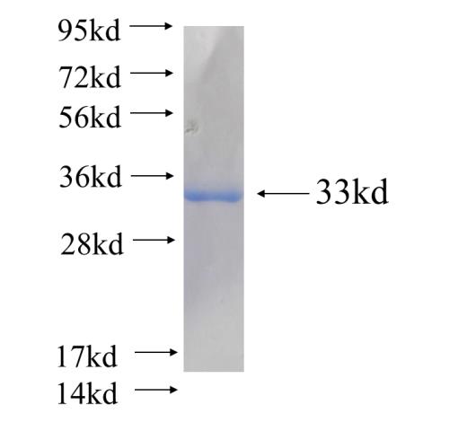 Recombinant human NDUFV2(Full length) SDS-PAGE