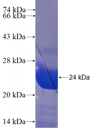 Recombinant Human ARHGAP6 SDS-PAGE