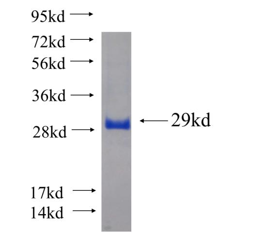 Recombinant human CHMP2B SDS-PAGE