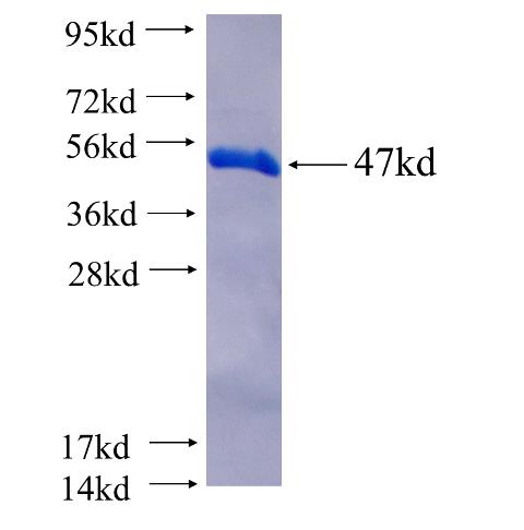 Recombinant human CYTH3 SDS-PAGE