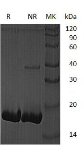 Human GMFB (His tag) recombinant protein