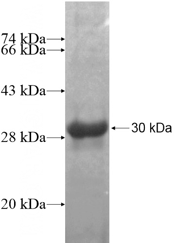 Recombinant Human CUL4B SDS-PAGE