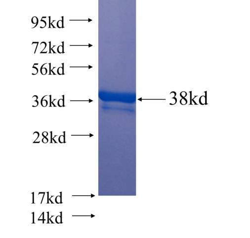 Recombinant human STK25 SDS-PAGE