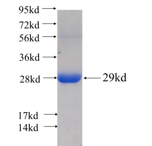 Recombinant human RNH1 SDS-PAGE
