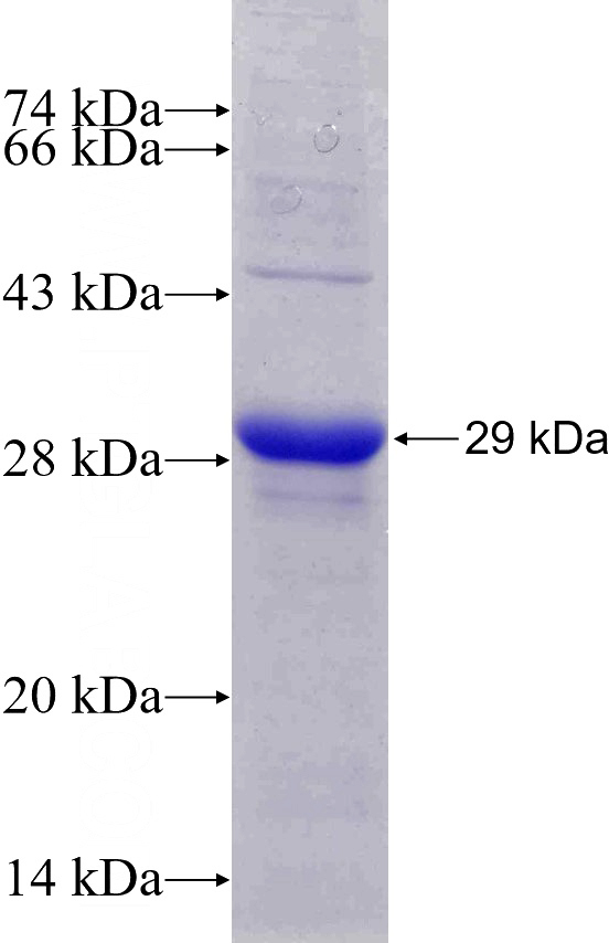Recombinant Human RELN SDS-PAGE