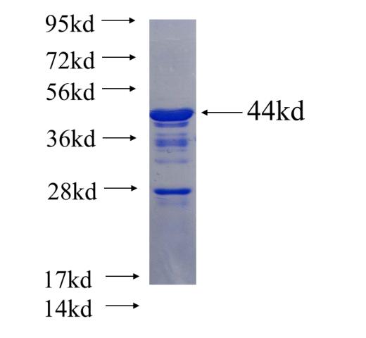 Recombinant human MAP2 SDS-PAGE