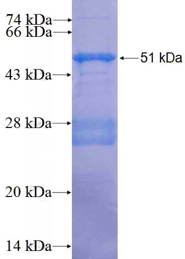 Recombinant Human ANGPTL3 SDS-PAGE