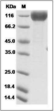 Cynomolgus IFNAR1 / IFNAR Protein (Fc Tag) SDS-PAGE