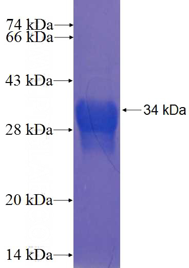 Recombinant Human FAM120C SDS-PAGE