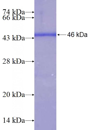 Recombinant Human KIN SDS-PAGE