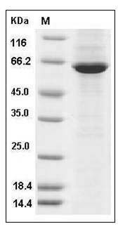 Human CSF1R / MCSF Receptor / CD115 Protein (aa 543-922, His & GST Tag) SDS-PAGE