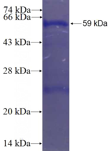Recombinant Human CDKL5 SDS-PAGE