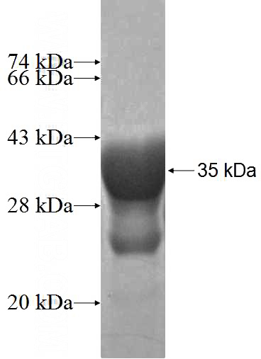 Recombinant Human AKAP7 SDS-PAGE
