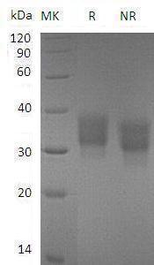 Mouse Fcgr2/Fcgr2b/Ly-17 (His tag) recombinant protein