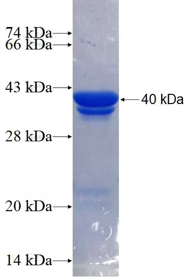 Recombinant Human SEPT7 SDS-PAGE