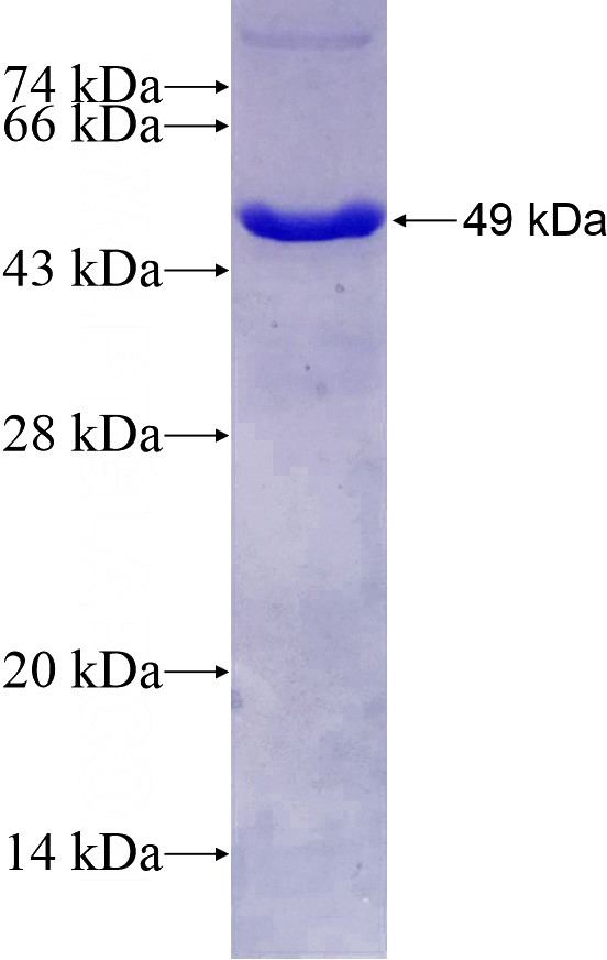 Recombinant Human FJX1 SDS-PAGE