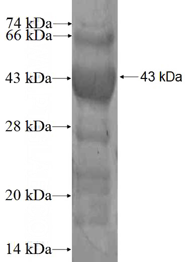 Recombinant Human RTKN SDS-PAGE
