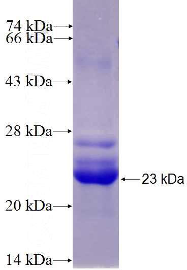 Recombinant Human ABCC8 SDS-PAGE