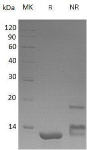 Human CCL18/AMAC1/DCCK1/MIP4/PARC/SCYA18 (His tag) recombinant protein