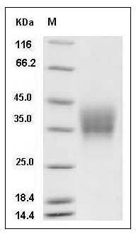 Mouse Oncostatin M / OSM Protein (His Tag) SDS-PAGE