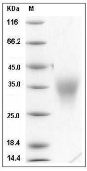 Mouse ACTRIIB / ACVR2B Protein (His Tag) SDS-PAGE