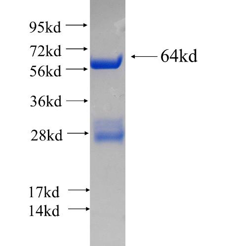 Recombinant human SAMD4B SDS-PAGE